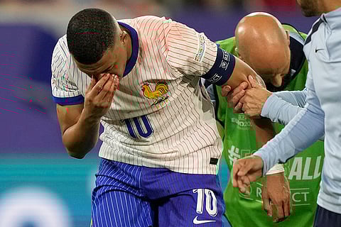 Kylian Mbappe holds his nose after suffering an injury